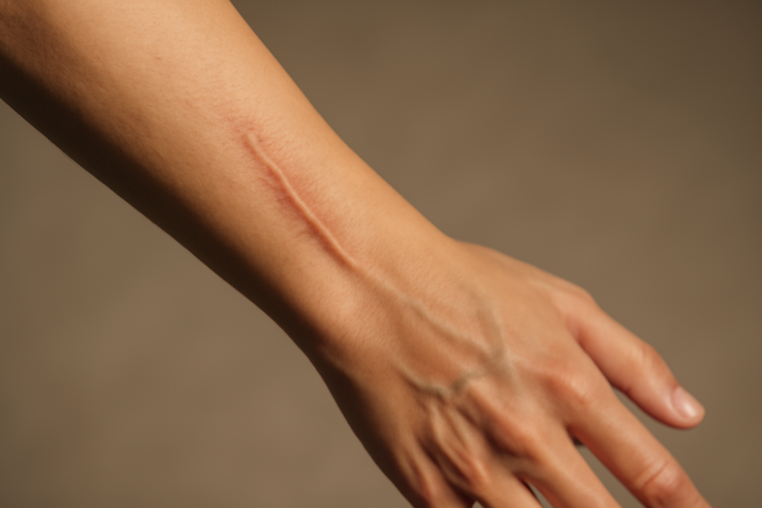 Cicatriz después de prótesis de rodilla
